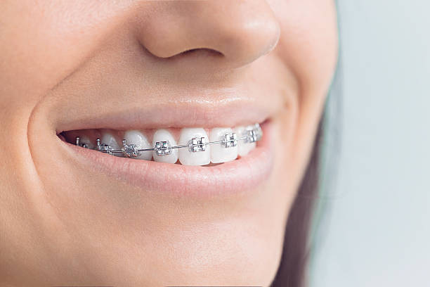 Best Dental Inlays and Onlays  in Haslett, MI